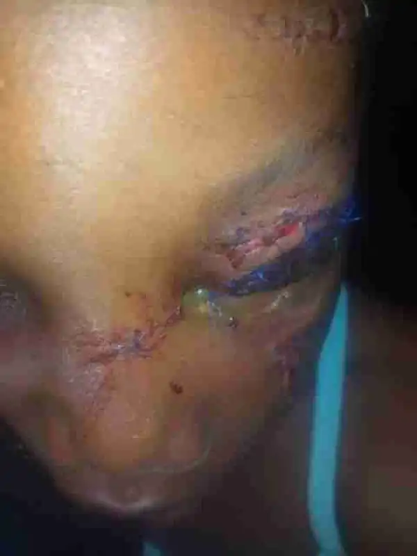 Prado Jeep Rams Into Toyota In Edo, Injures Kids Returning From School (Graphic Pics)
